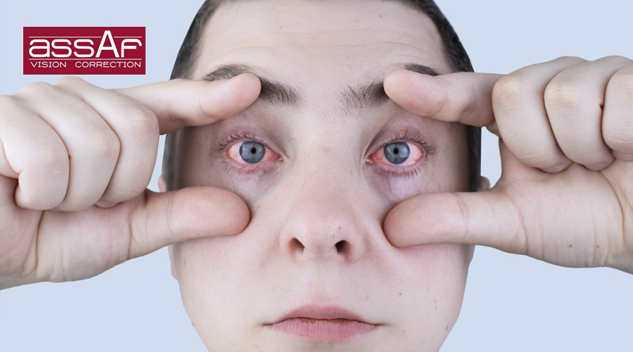 علاج التهاب العين وأسبابه