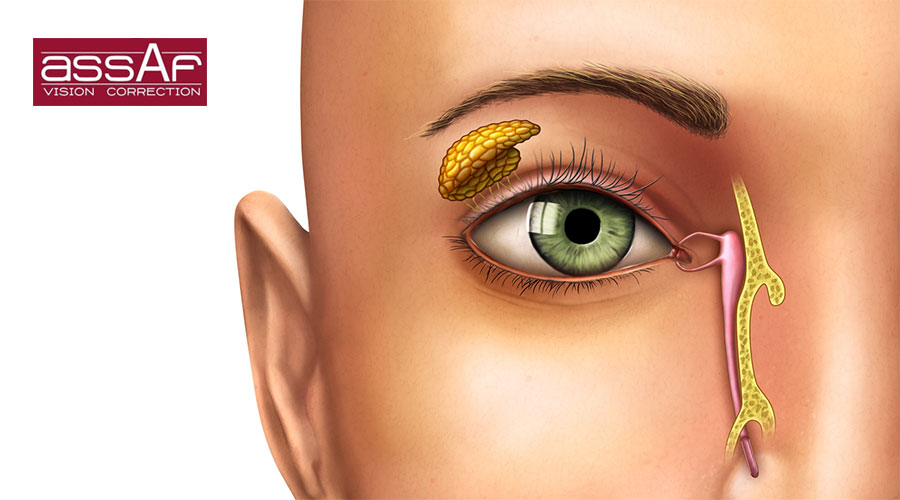 علاج انسداد القنوات الدمعية