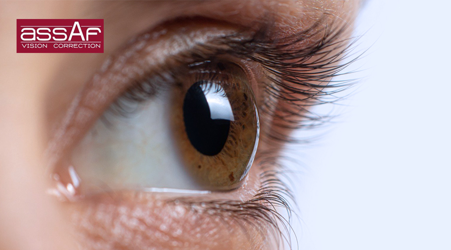 Keratoconus causes and treatment