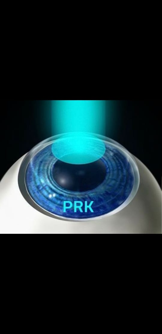 عملية الليزر السطحى Prk